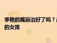 李艳的嘴唇治好了吗？虽然不完美 但她已经成长为一个自信的女孩