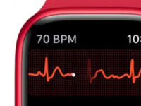 研究表明AppleWatch可以准确预测压力水平